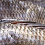 1653947733_7-minHealthDoctors-use-tilapia-skin-to-perform-vaginal-reconstruction-in