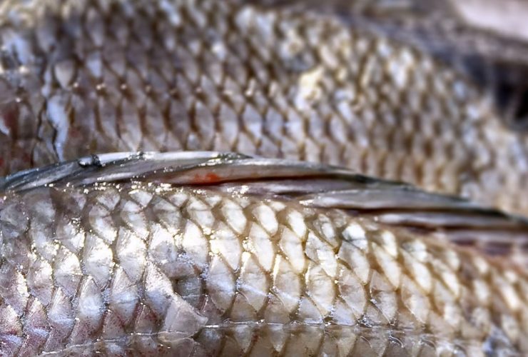 1653947733_7-minHealthDoctors-use-tilapia-skin-to-perform-vaginal-reconstruction-in