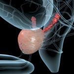 What-is-Enlarged-Prostate-and-When-is-Surgery-Necessary