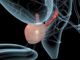 O que é próstata aumentada e quando a cirurgia é necessária? 6 What-is-Enlarged-Prostate-and-When-is-Surgery-Necessary