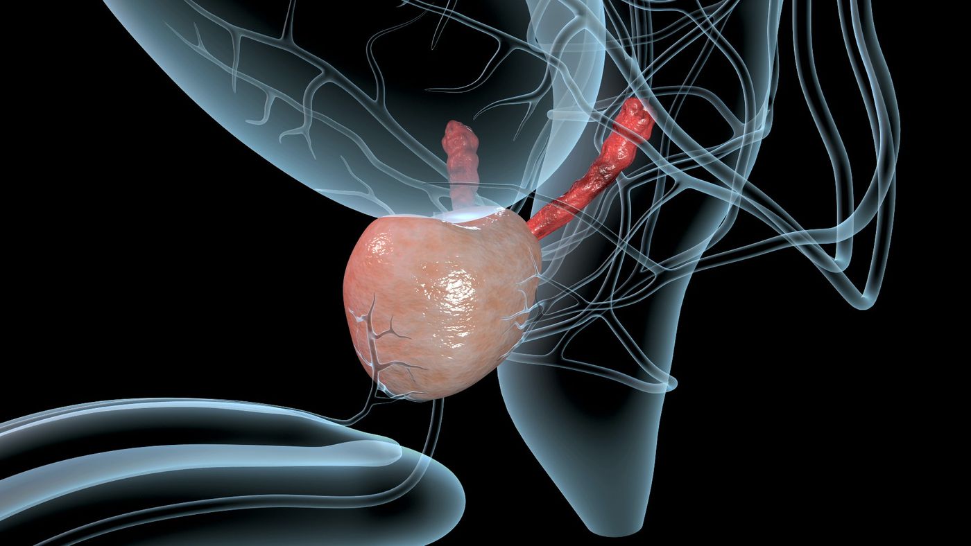 Qu'est-ce-que-l'hypertrophie-de-la-prostate-et-quand-une-chirurgie-est-elle-nécessaire