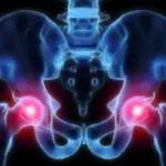 Existem alongamentos que você pode fazer para osteoartrite do quadril?