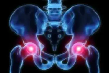 Existem alongamentos que você pode fazer para osteoartrite do quadril? 7 Existem alongamentos que você pode fazer para osteoartrite do quadril?