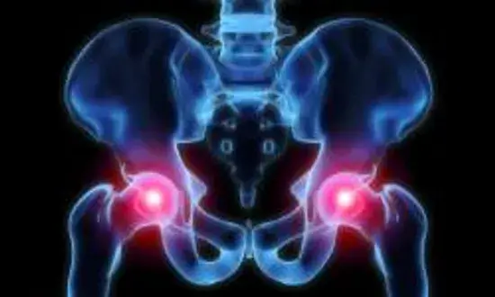 Existem alongamentos que você pode fazer para osteoartrite do quadril?