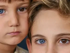 olhos mais raras do mundo