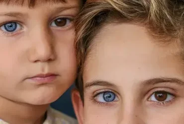 olhos mais raras do mundo