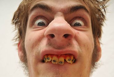 O que significa sonhar com homem feio? 3 sonhar com homem feio