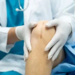 reduzir a aparência de uma cicatriz