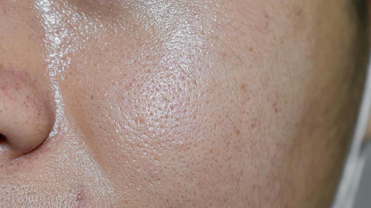 oleosa