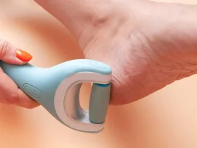 O que fazer com seus calos quando uma pedra-pomes não está resolvendo 5 pedra-pomes